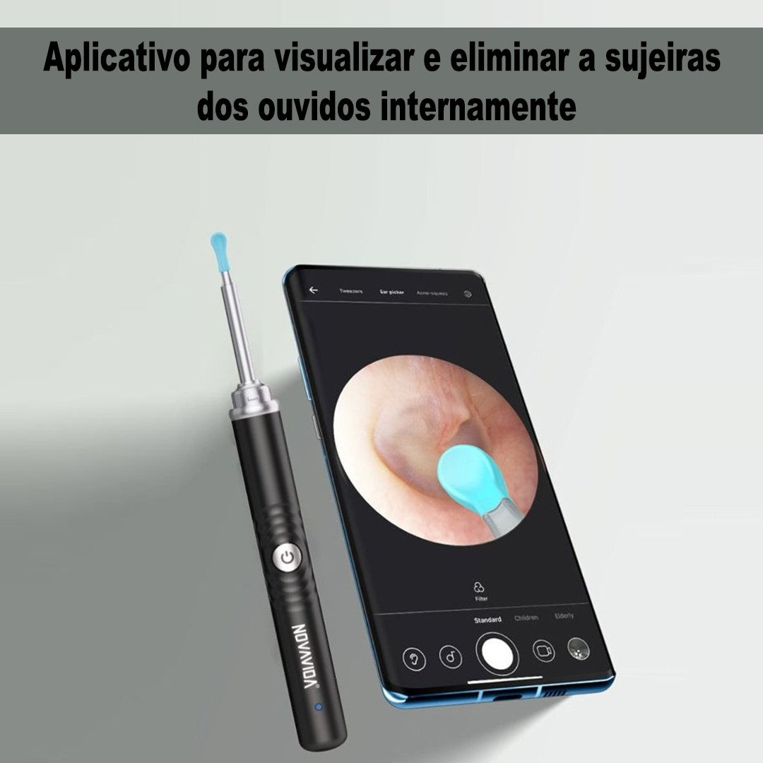 Limpador de Ouvido Completo com Pinça Lanterna Seringa e Otoscópio