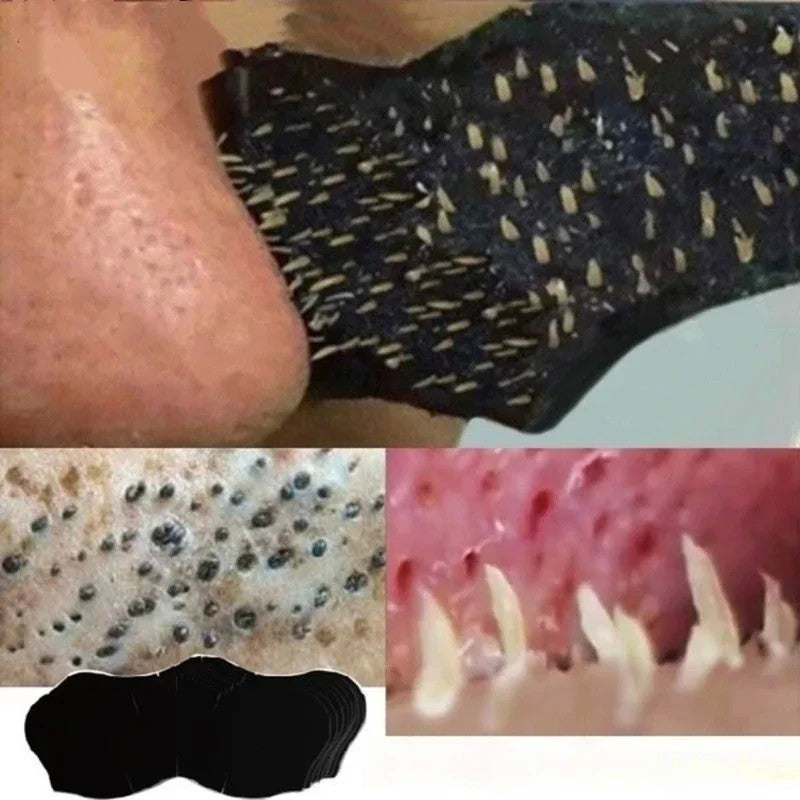 Mascara removedora de cravos